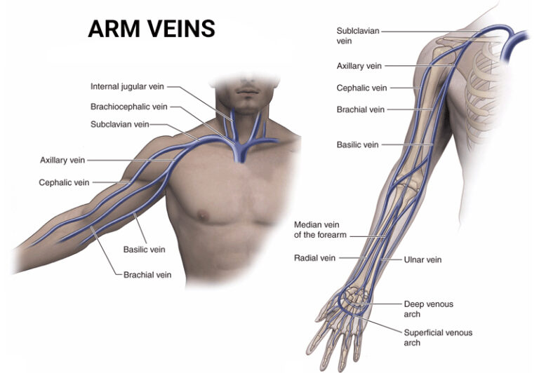 Arm Veins Treatment In Nyc Nj Vein Care Center